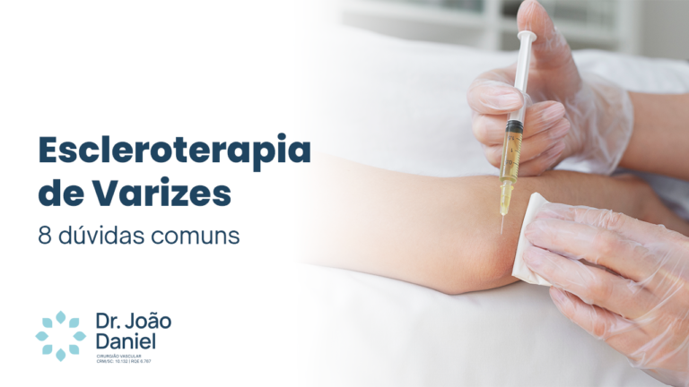 Escleroterapia de Varizes