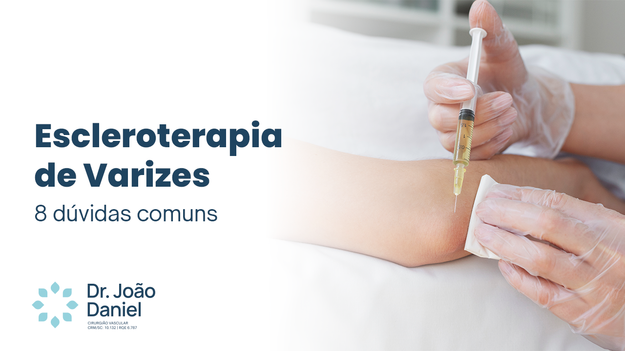 Escleroterapia de Varizes