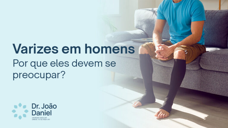 Varizes em homens | Por que eles devem se preocupar?