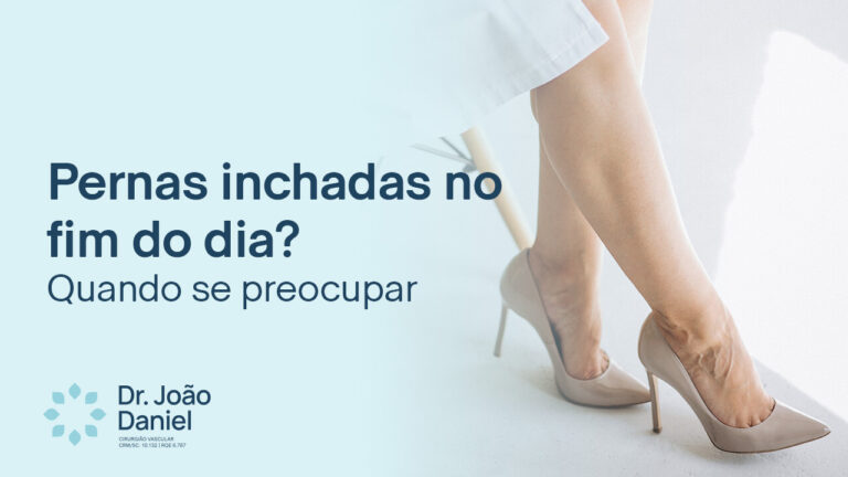 Pernas inchadas no fim do dia? Quando se preocupar
