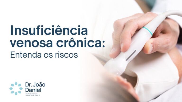 Insuficiência venosa crônica