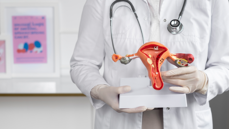 Embolização de mioma